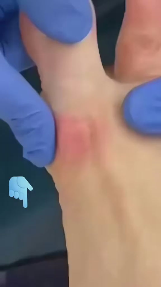 Meia Ortopédica para Joanete